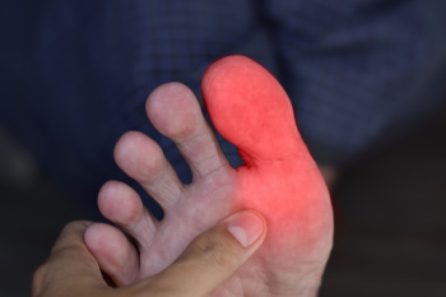 Causes Of Toe Swelling